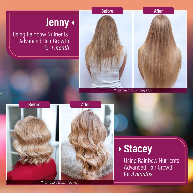 Vitaminas Para El Crecimiento Del Cabello, Rainbow Nutrients