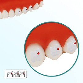 10 Paquetes de Soportes Dentales Ortodónticos de Cerámica, Brackets MBT/Roth de 022" Ranura 345 con Gancho (Soporte MBT)