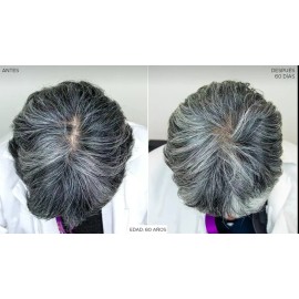 Locion Fortificante Para Caida Y Crecimiento Del Cabello