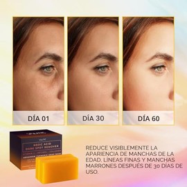 VALITIC Barras de jabón eliminadoras de manchas oscuras de ácido kójico con vitamina C, retinol, colágeno, cúrcuma, complejo japonés original infundid