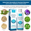 Roycederm Champú para la psoriasis, dermatitis seborreica, foliculitis y caspa,