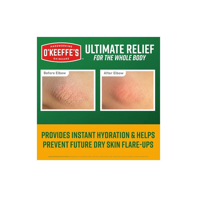 Crema Corporal O'keeffe's Skin Repair Ultimate Relief, Tubo