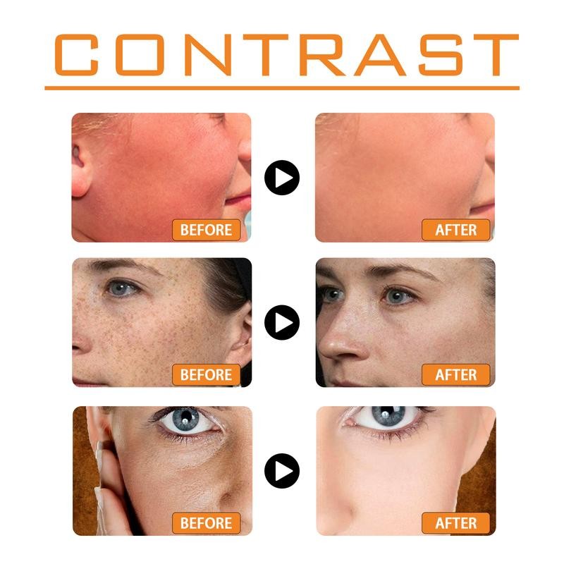 ouhoe Spf 100 Face Sunscreen Moisturizer - Travel Size Sunscreen