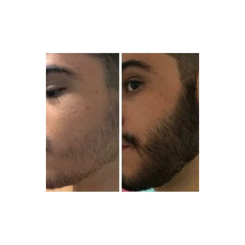 Barba Gel Crema Barba Bigote Barba Oferta Novocrin Barba