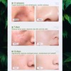 Premium Avocado Whitening Bubble Mask for Blackhead Removal & Pore