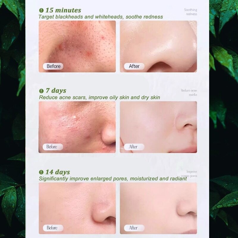 Premium Avocado Whitening Bubble Mask for Blackhead Removal & Pore