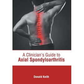A Clinician's Guide to Axial Spondyloarthritis