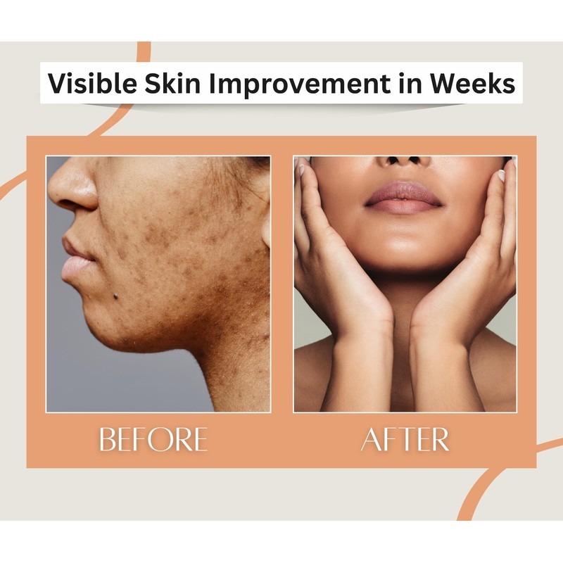 Earth N Pure Babchi Oil (Bakuchi Oil) Cold Pressed, Natural