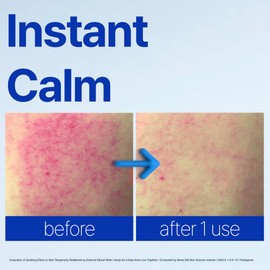 ISOI ACNI Dr. 1st Speedy Gel Cream, Oil-Free Soothing & Hydrating Gel for Oily and Sensitive Skin, Lightweight Cooling Moisturizer for Redness Relief, Korean Skin Care (1.69 fl.oz, 50ml)