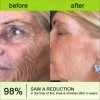 ! ¡crema Firmador Antirrugas Retinol Shot!