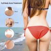 Butt Acne Clearing Treatment, Maximum Strength Body Cream for Back,
