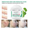 Crema Apoyo Desvanecimiento Cicatrices Cacarizos Queloides