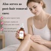 2 Onzas De Aceite De Cyperus Rotundus, Reduce El Vello