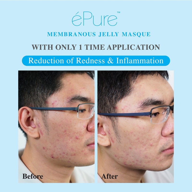 ePure Membranous Jelly Masque Box (5's)