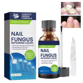 Nail Repairing Liquid, Nails Fast Effective Grey Nail Repair Liquid for Toenail Fingernails, Protects Thick, Broken And Discolored Nails, Fix Renew Damaged for Toenail and Fingernail