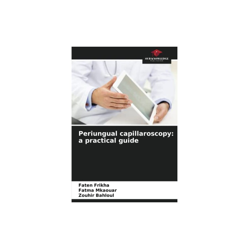 Periungual capillaroscopy: a practical guide