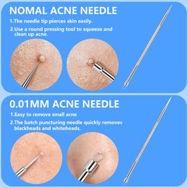 Juego de 5 extractores de comedones para quitar espinillas, herramientas profesionales de acero inoxidable para eliminar espinillas, acné y manchas, pinzas curvadas incluidas