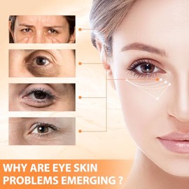 Tbexem Bálsamo Para Ojos Revive Glow Con Vitamina C, Crema Hidratante Para El Contorno De Ojos, Mejora Las Ojeras, Ilumina El Tono De La Piel, Reduce 
