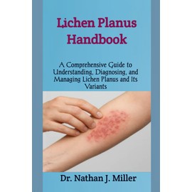 Lichen Planus Handbook: A Comprehensive Guide to Understanding, Diagnosing, and Managing Lichen Planus and Its Variants
