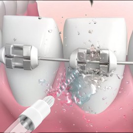 Setonia Replacement Tips for Water Flosser Classic Jet Tips Replacement Parts （8 counts)