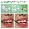 Temporary Veneers Kit for Women and Men, Tooth Replacement Kit,