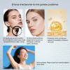 Crema Reparadora Facial 20g, Adecuada Para Piel Con Acné