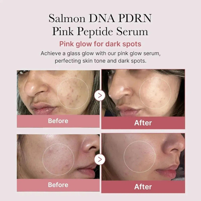 Mascarilla Gel Medicube Pink Glass Glow Skin Trio Uni
