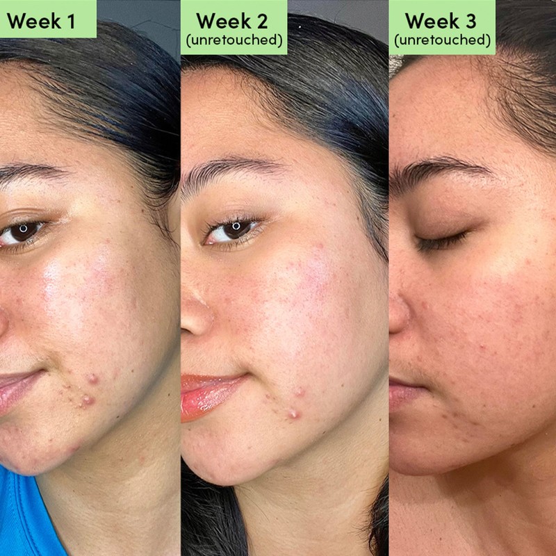 Sand & Sky Oil Control - Clearing Face Mask 100g