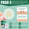 Lunixila Microagujas Para Parches Antiacné,conjunto De 3 En1