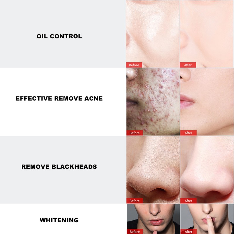 MAN CODES Men Morning Evening Skin Deep Cleansing Whitening Hydrating
