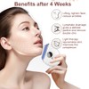 Horuili® Gesichtsmassagegerät, Gesichtsschaber, Gua Sha Elektrisch mit Vibration & Wärme,