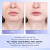 ANLAN Face Massager, Anti-Wrinkle Face Device with 3 Modes 45°C
