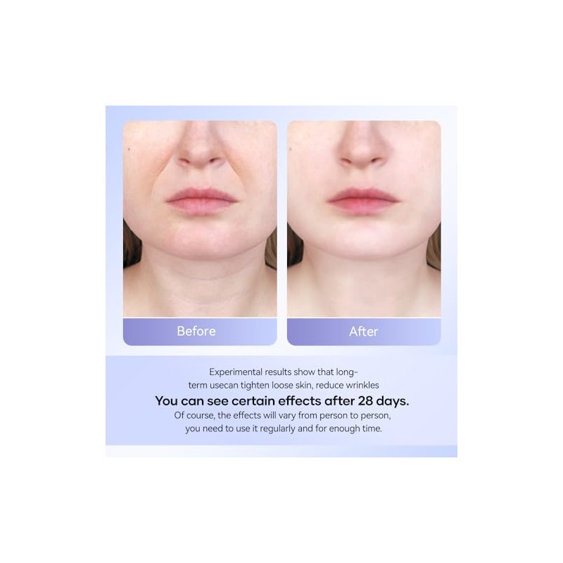 ANLAN Face Massager, Anti-Wrinkle Face Device with 3 Modes 45°C