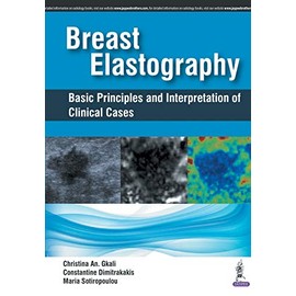 Breast Elastography: Basic Principles and Interpretation of Clinical Cases