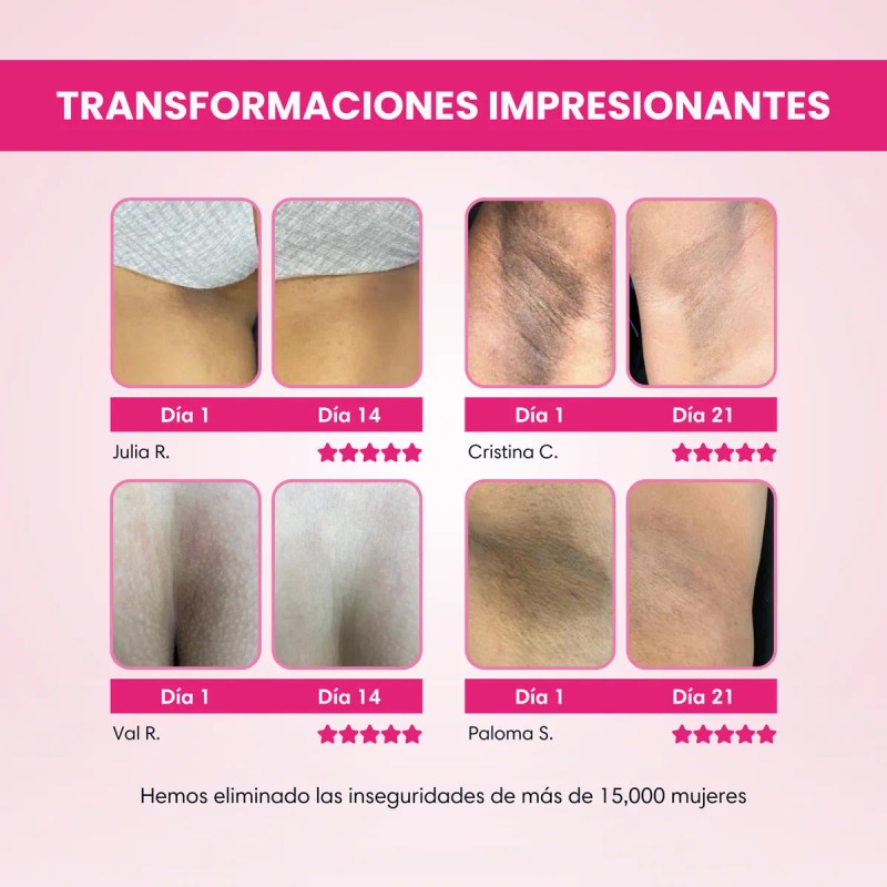 Crema Corporal Aclarante Antimanchas Ácido Glicólico 30g Frutal