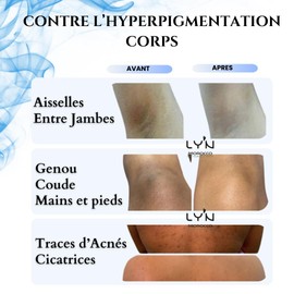 100% Natural & Organic Face Mask with Nila, Rice, Almond & Oliban for Dark and Tired Skin Instant Results: Bosster d'Eclat, Ilumin and Cleanses the Complexion