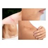 2 Pack Kitocream 3.5g Lineas De Expresion, Cicatrices