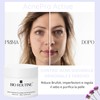 Bio Routine AcnePro Active, Akne-Creme für das Gesicht, entfernt Akne,