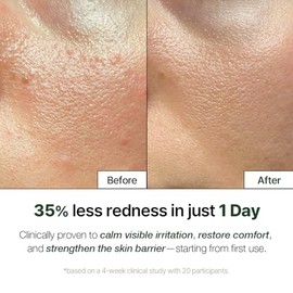 NATURAL DERMA PROJECT NDP Cica Cream - Crema hidratante facial de gel para aliviar quemaduras solares, hidratante coreano ligero para pieles sensibles