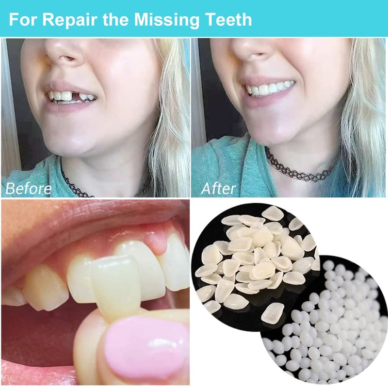 Brige Tooth Repair kit for Filling The Missing Broken Tooth