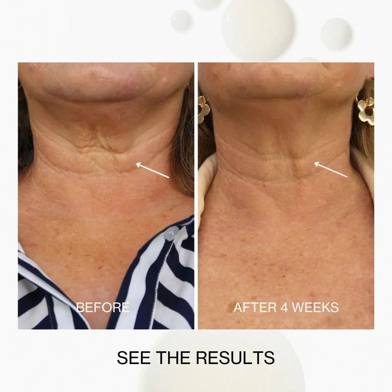 The Jojoba Company Neck & Decolletage Lifting Concentrate 50ml