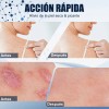 Crema Eczema Hidratante, Aliviar Piel Seca Y Picazón 20g