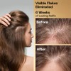 B FENG HUA Anti Dandruff Shampoo Oil & Flake Control