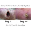 SilvrSTAT Antibacterial Wound Dressing Gel 3 OZ