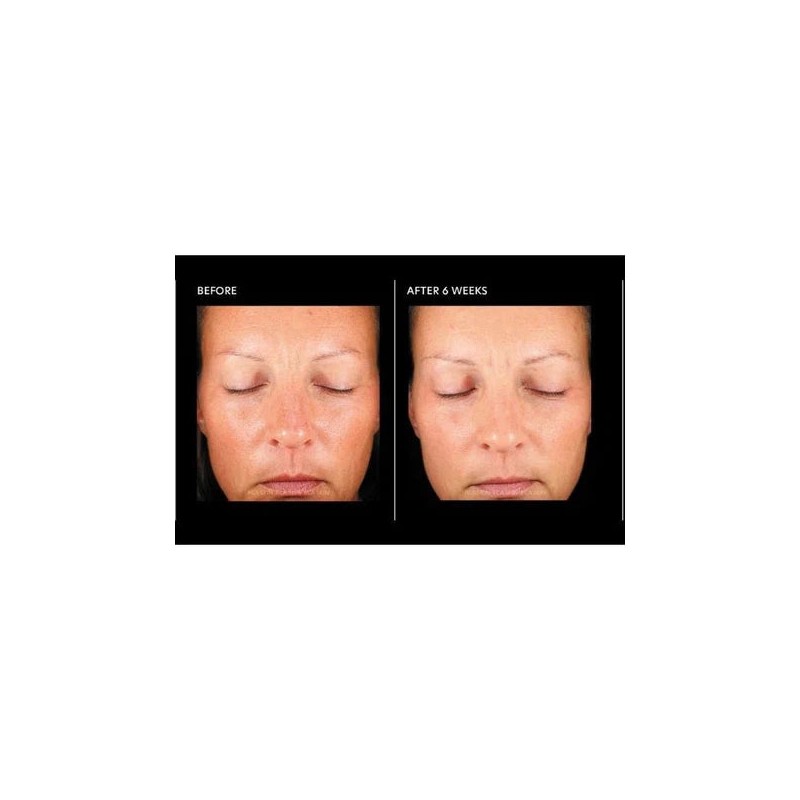 PCA Skin Hyaluronic Acid Overnight Mask 51g