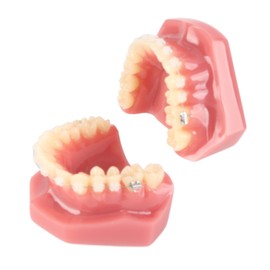 Ceramic Dental Orthodontic Demonstration Model Teeth Model with Metal Wires and Bracket for Teaching Learning