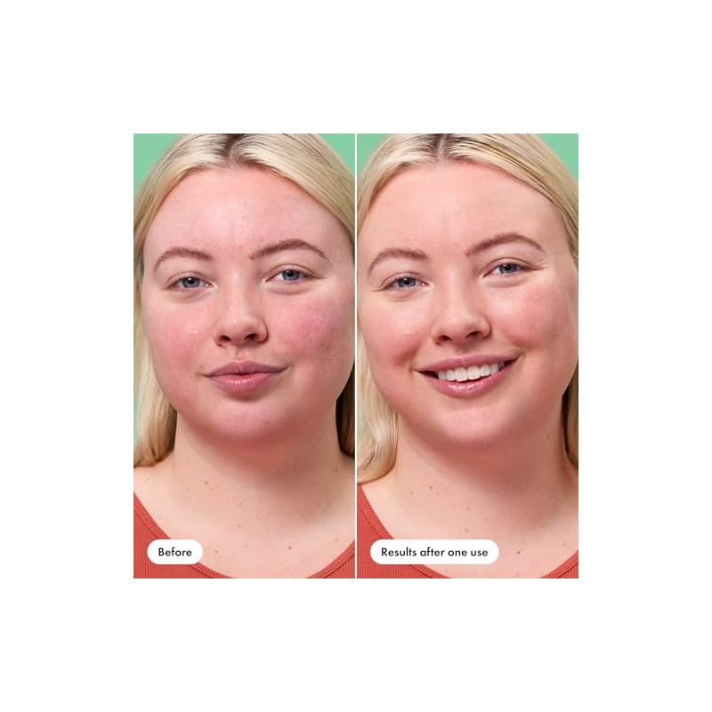 Bálsamo de rescate + Red Correct by Hero Cosmetics (15