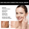 GFOUK Melanin Correcting Facial Serum,Dark Spot Face Serum,Bright Skin Dark