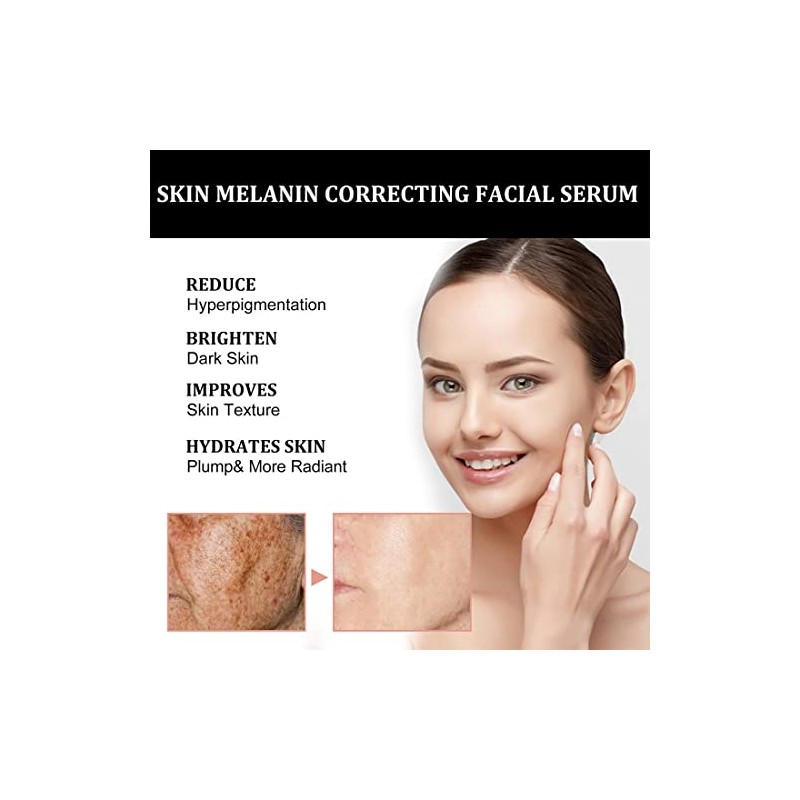 GFOUK Melanin Correcting Facial Serum,Dark Spot Face Serum,Bright Skin Dark