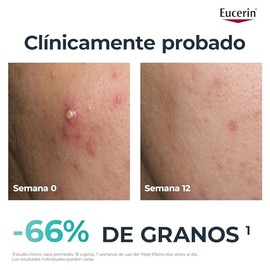 Eucerin Dermopure Tripple Effect Serum 40Ml